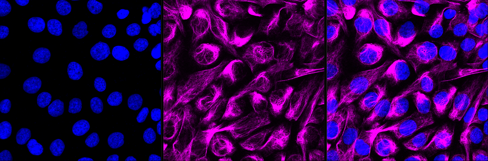 ACAP2 Rabbit monoclonal antibody
