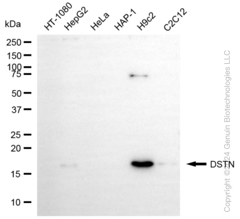 DSTN antibody