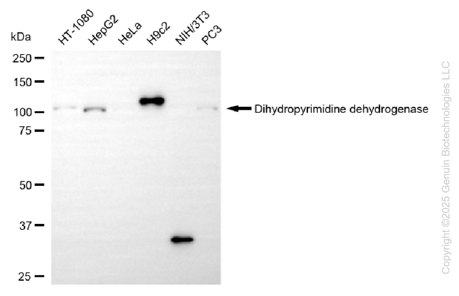 DPYD antibody