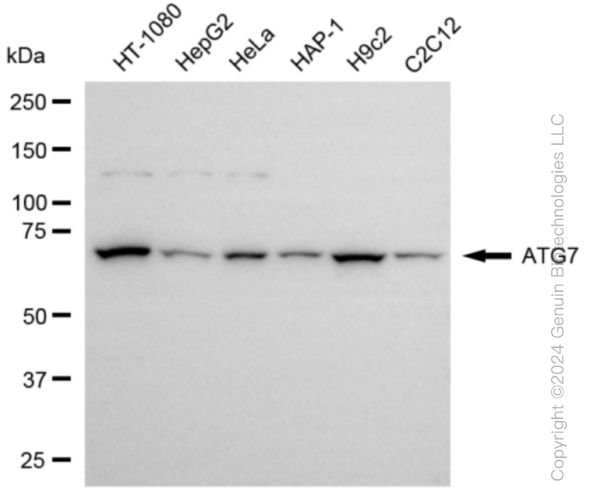 ATG7 antibody