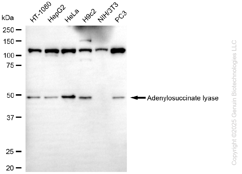 ADSL antibody