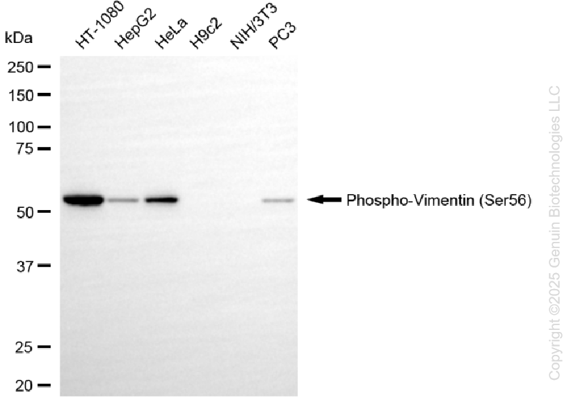 VIM antibody