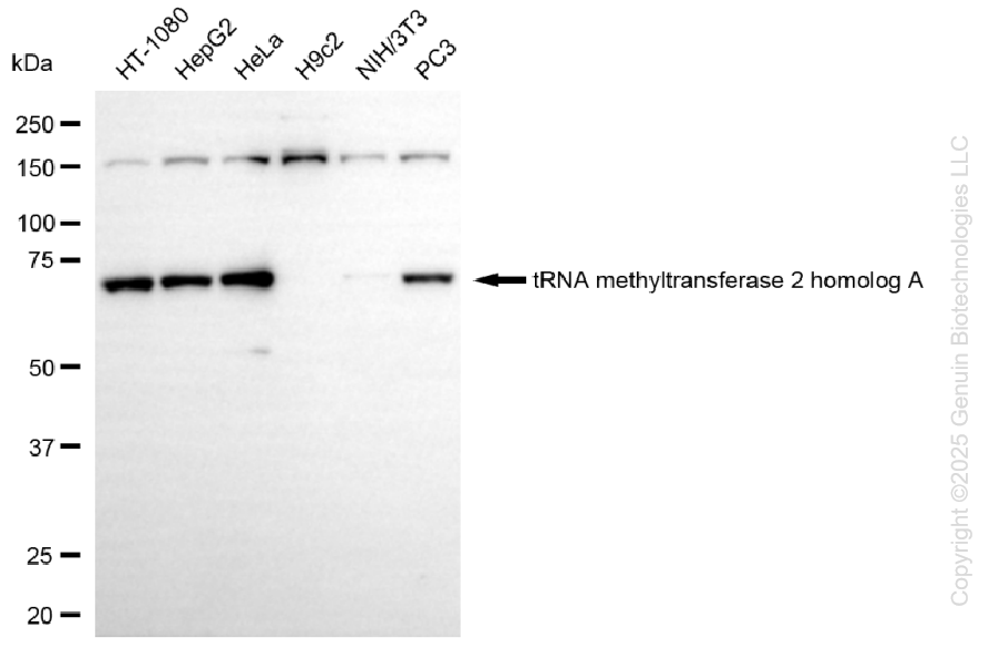 TRMT2A antibody