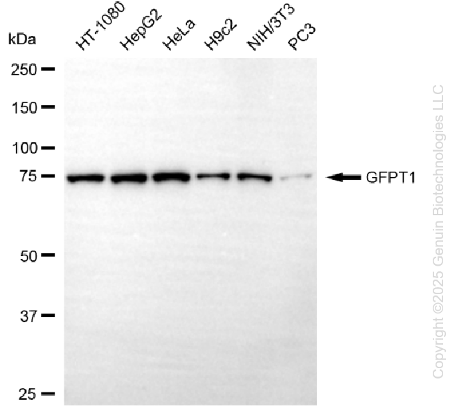 GFPT1 antibody