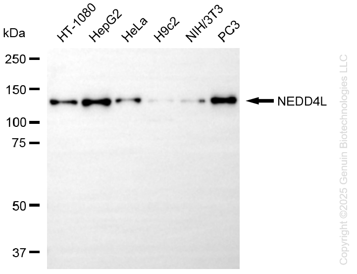 NEDD4L antibody