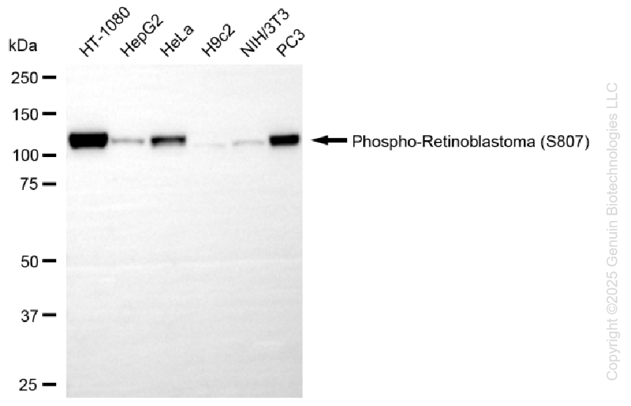 RB1 antibody
