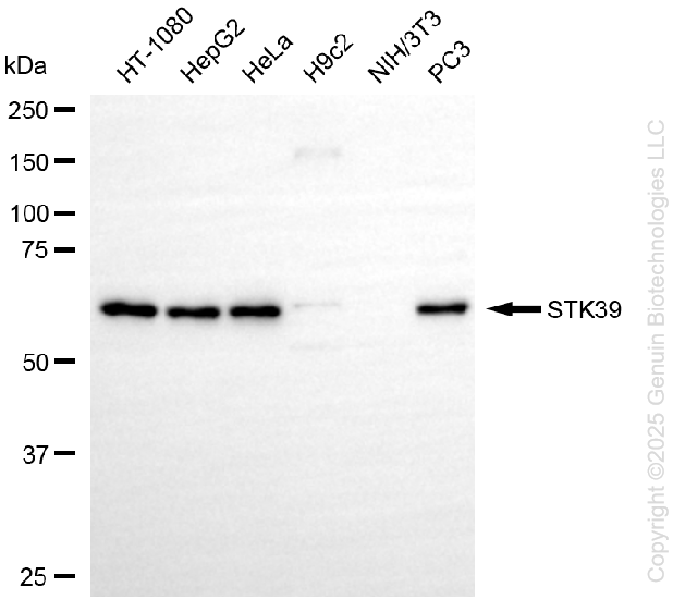 STK39 antibody