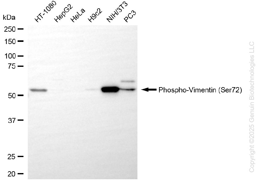 VIM antibody