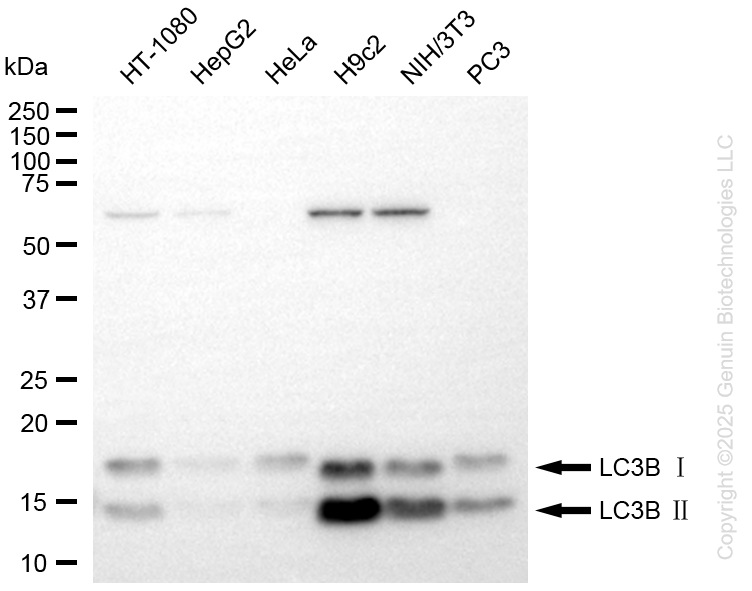 MAP1LC3B antibody