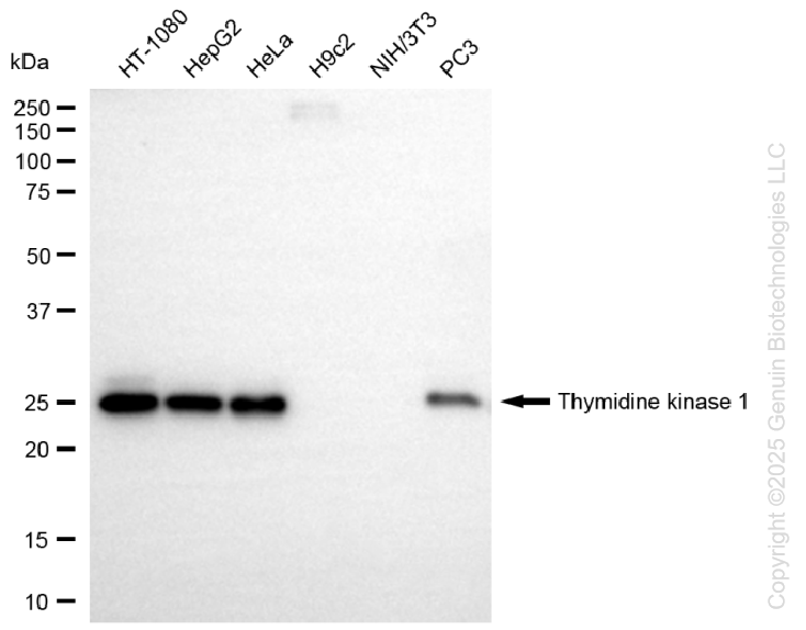 TK1 antibody