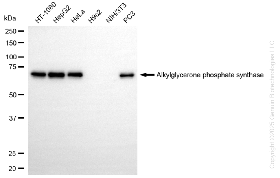 AGPS antibody