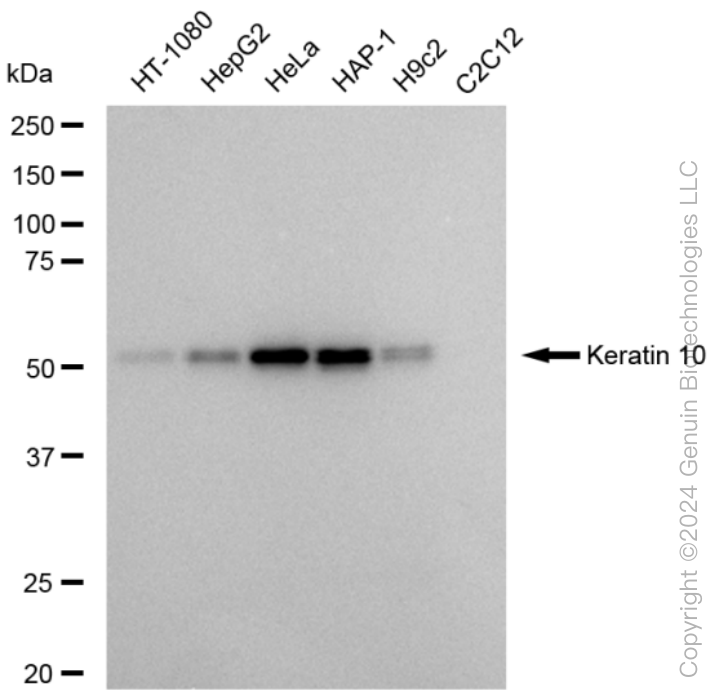 KRT10 antibody