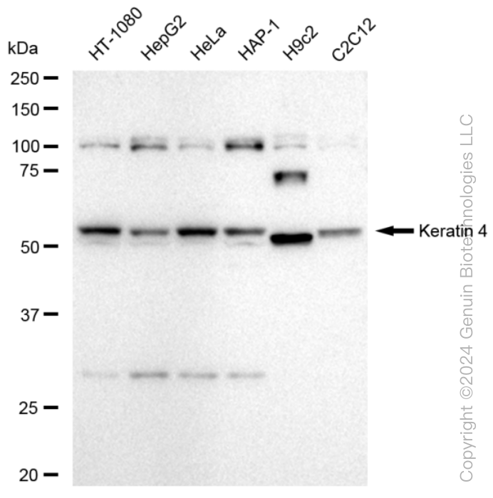 KRT4 antibody
