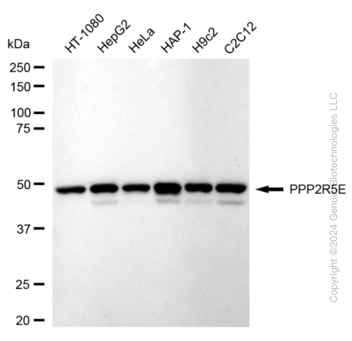PPP2R5E antibody