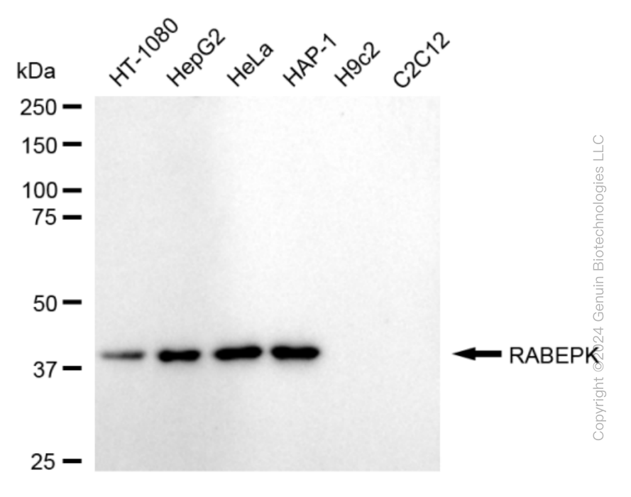 RABEPK antibody