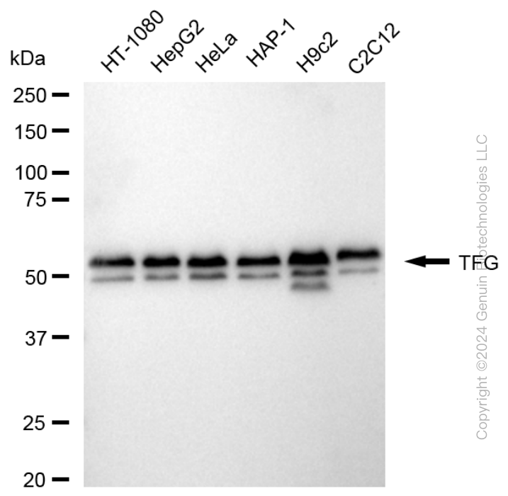 TFG antibody