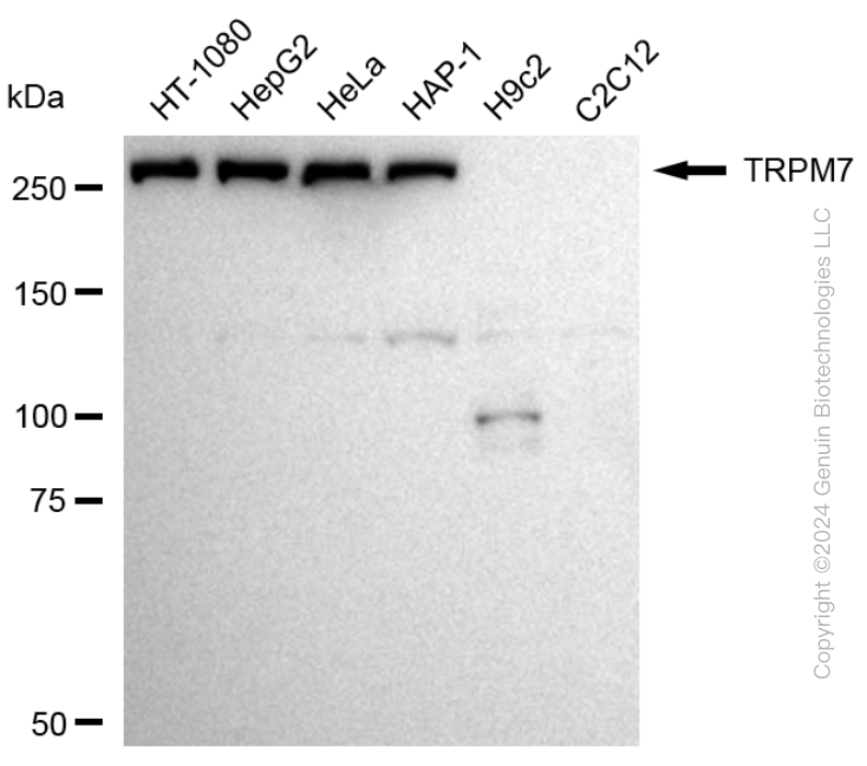 TRPM7 antibody