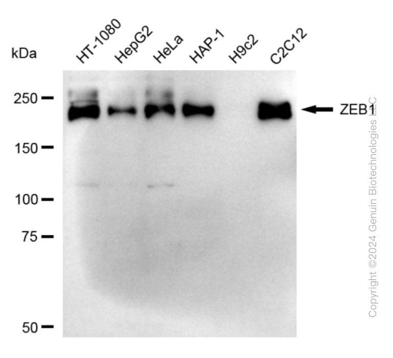 ZEB1 antibody