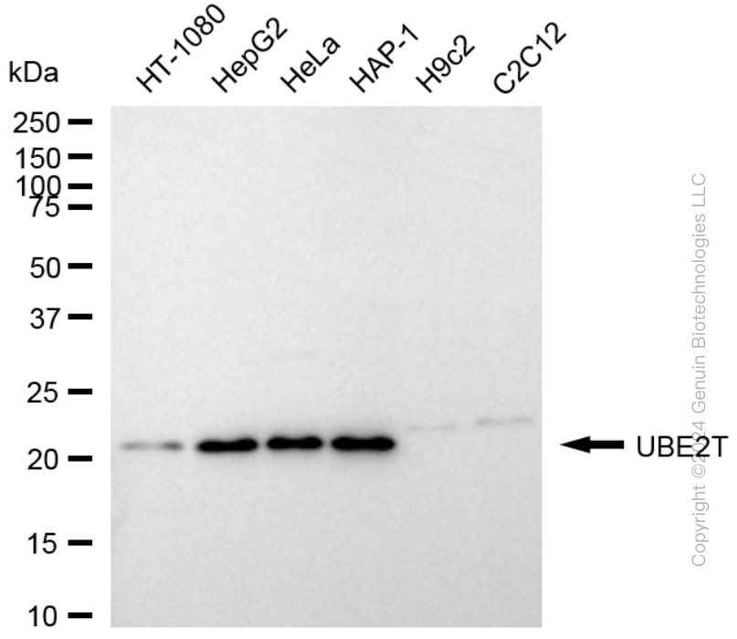 UBE2T antibody