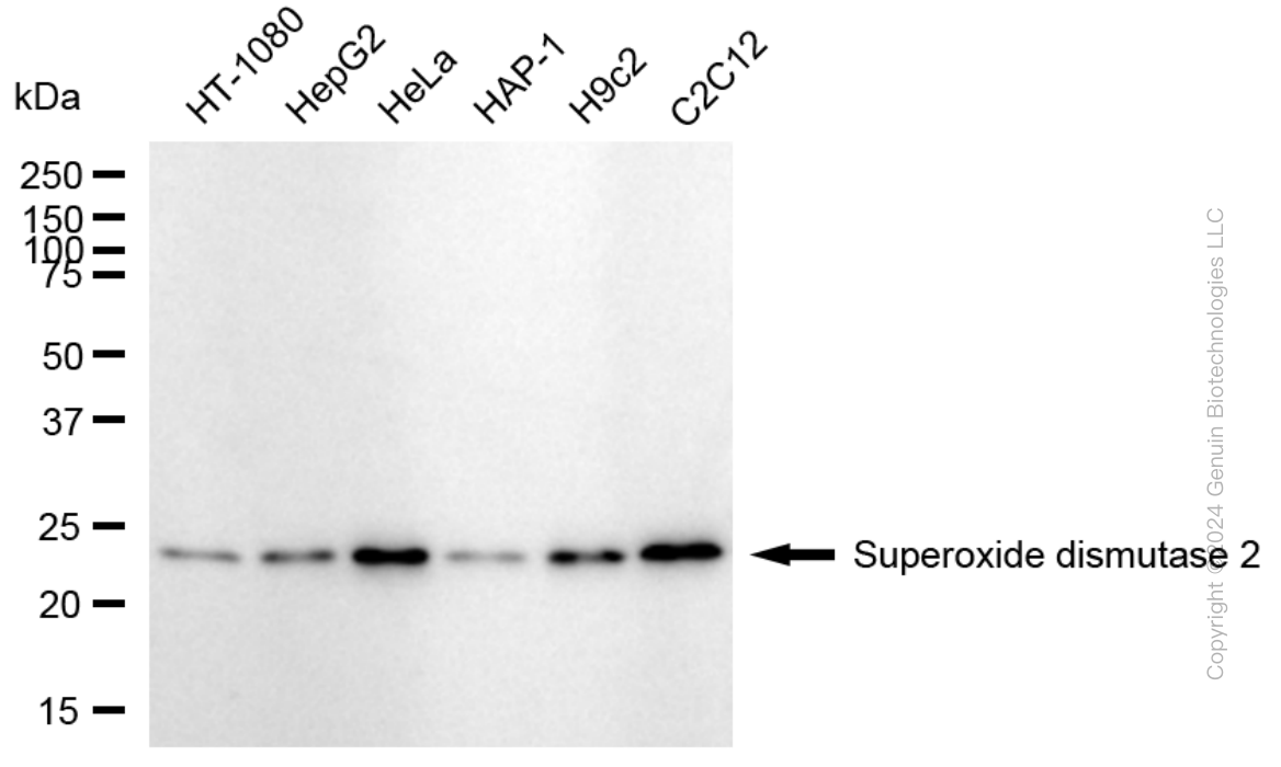 SOD2 antibody