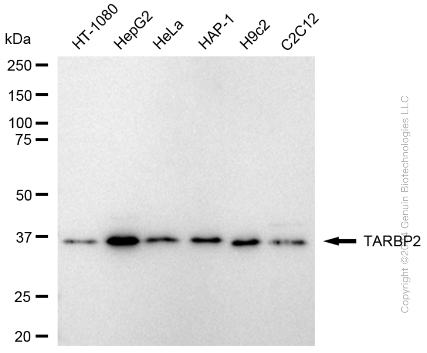 TARBP2 antibody