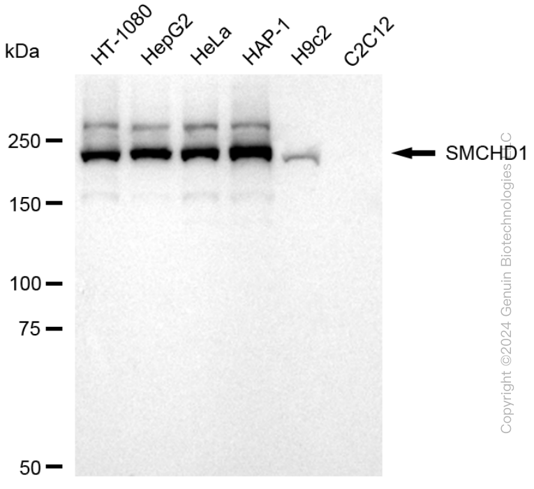 SMCHD1 antibody