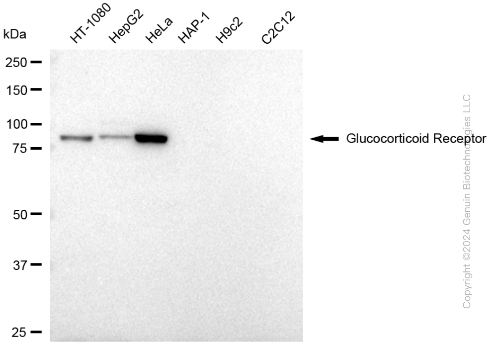 NR3C1 antibody