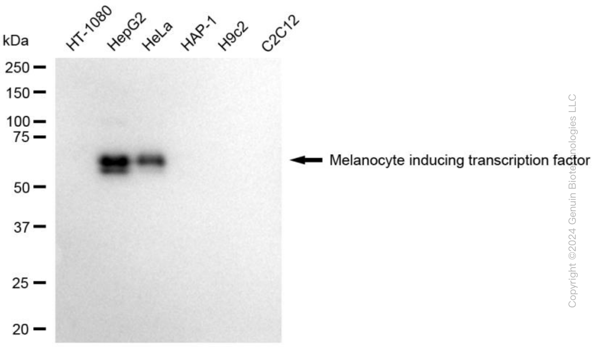 MITF antibody