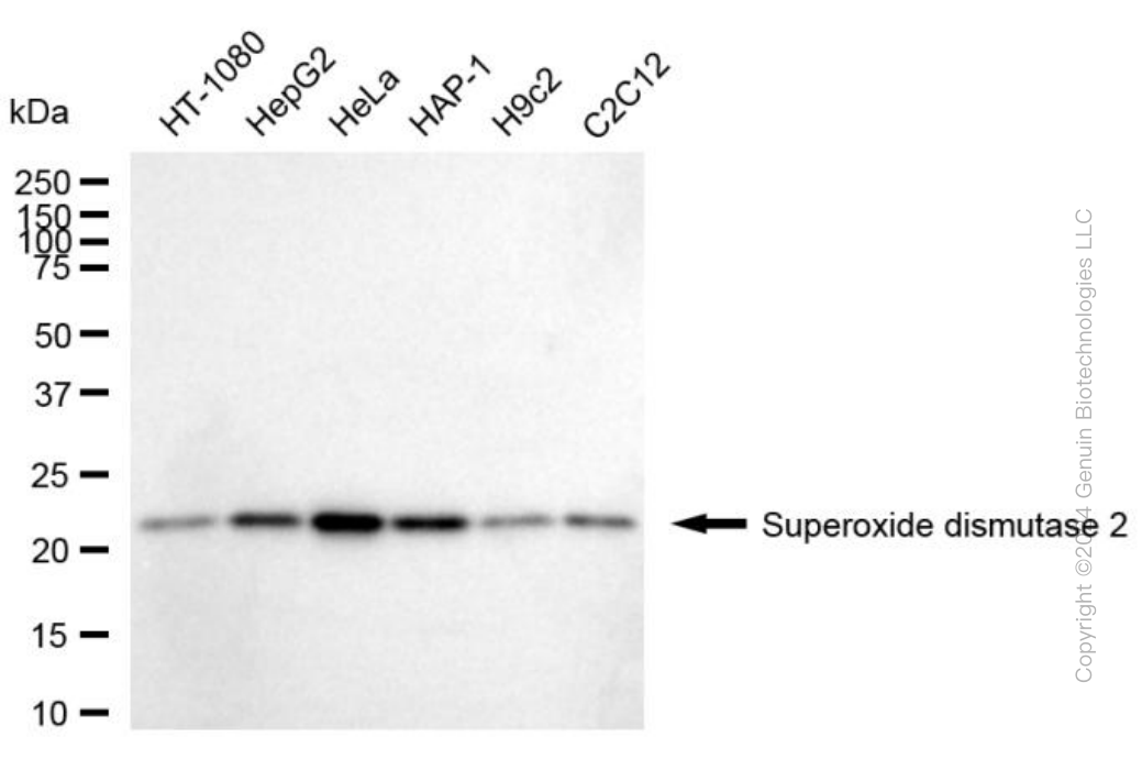 SOD2 antibody