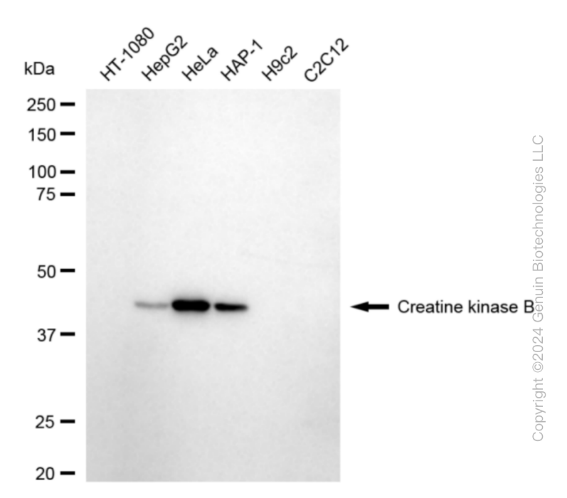 CKB antibody