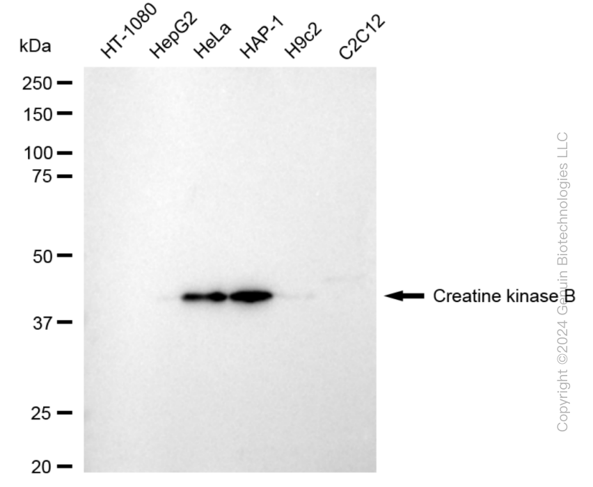 CKB antibody