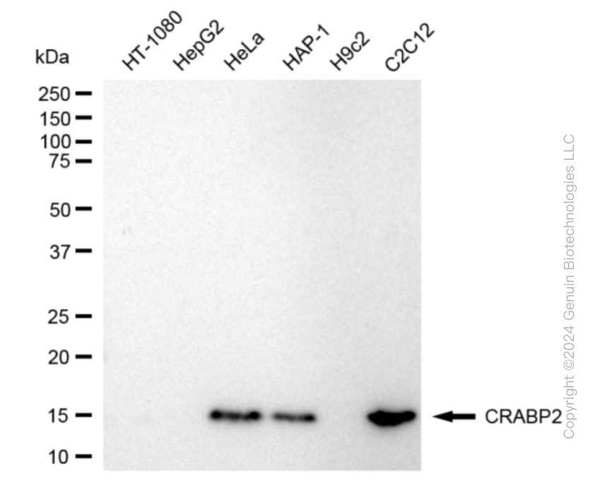 CRABP2 antibody