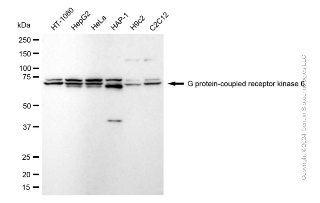 GRK6 antibody
