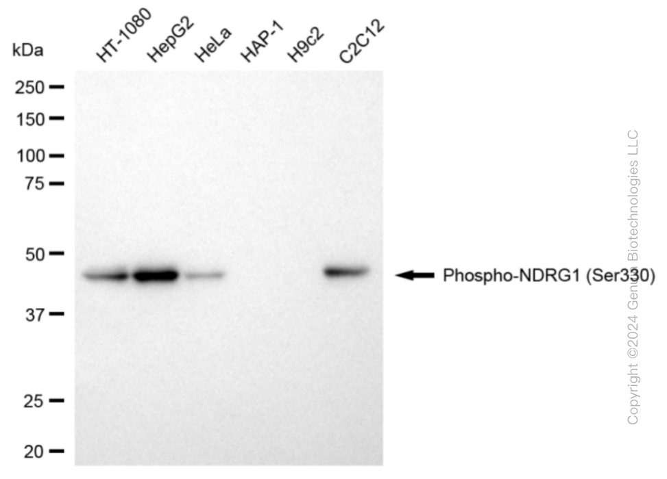 NDRG1 antibody