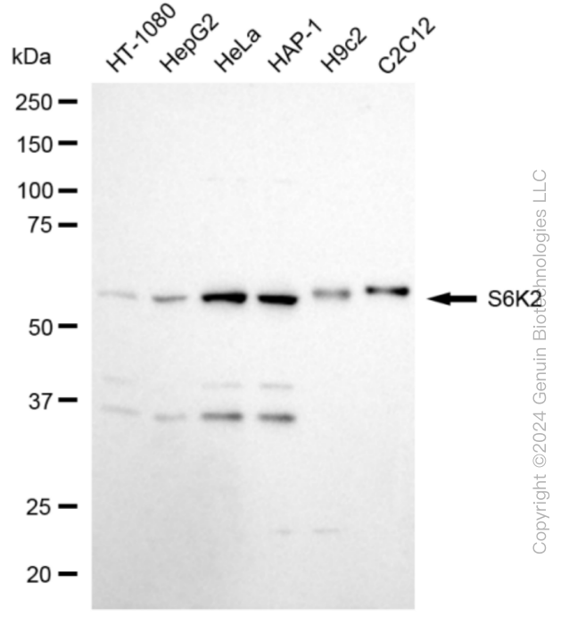 RPS6KB2 antibody