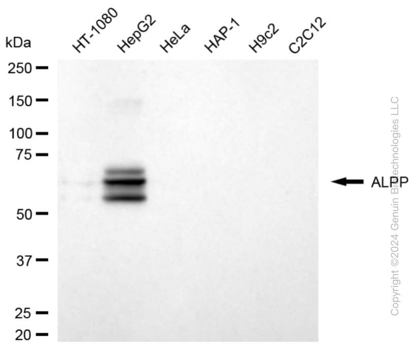 ALPP antibody