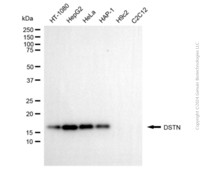DSTN antibody