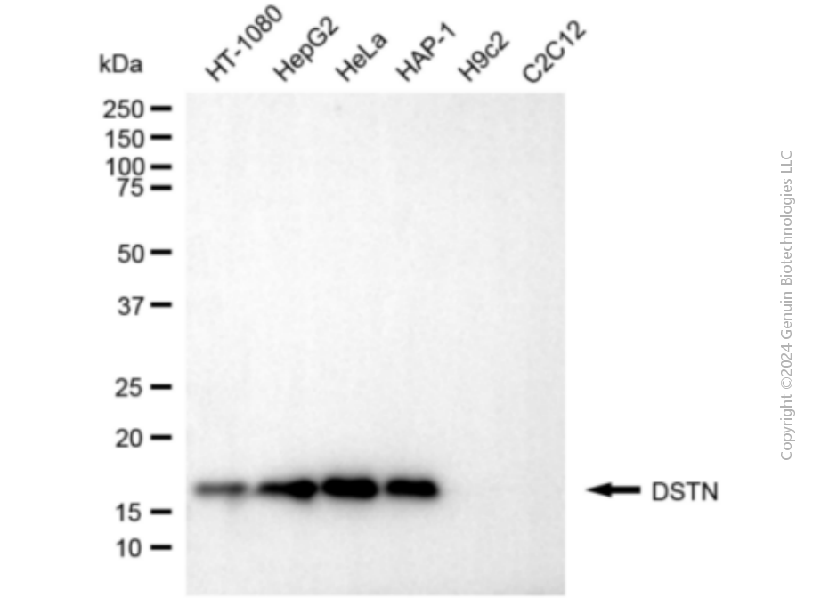 DSTN antibody