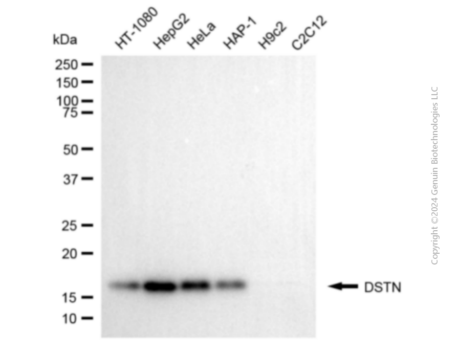 DSTN antibody