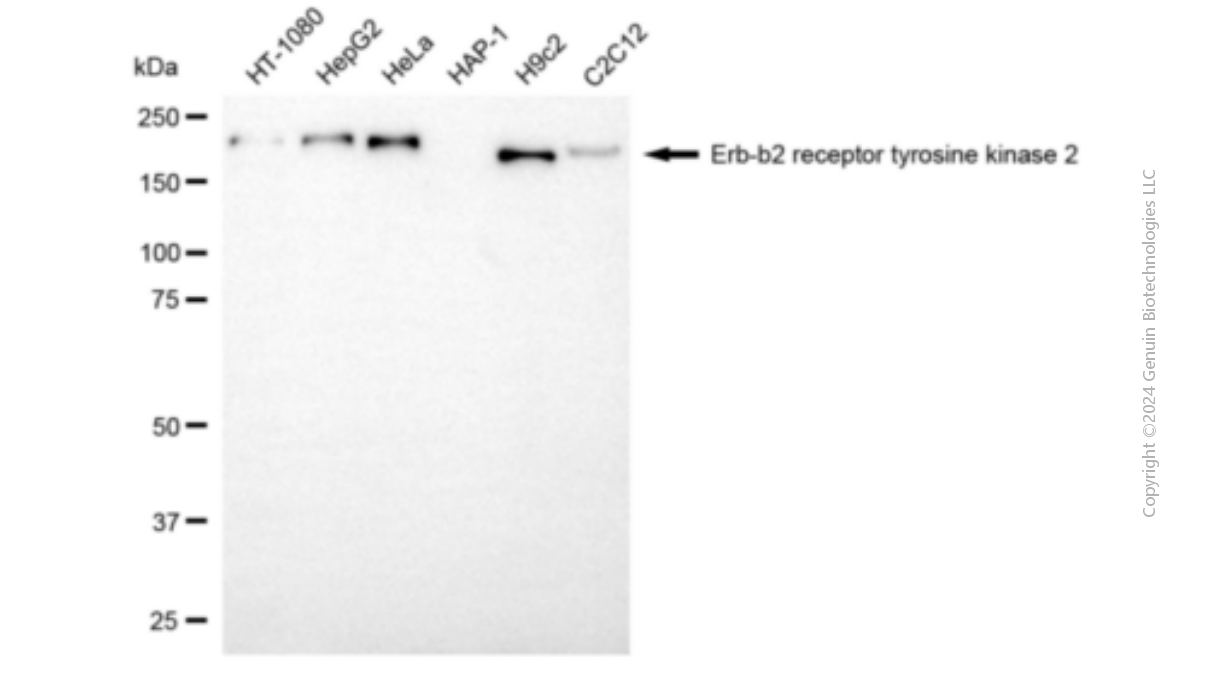 ERBB2 antibody