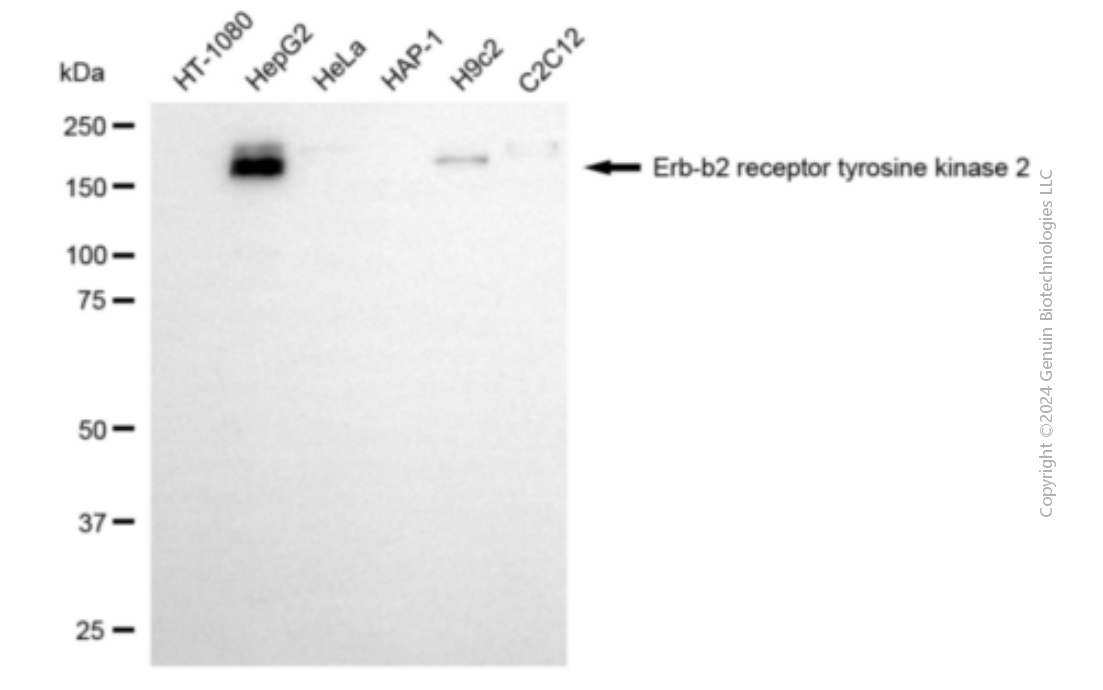 ERBB2 antibody