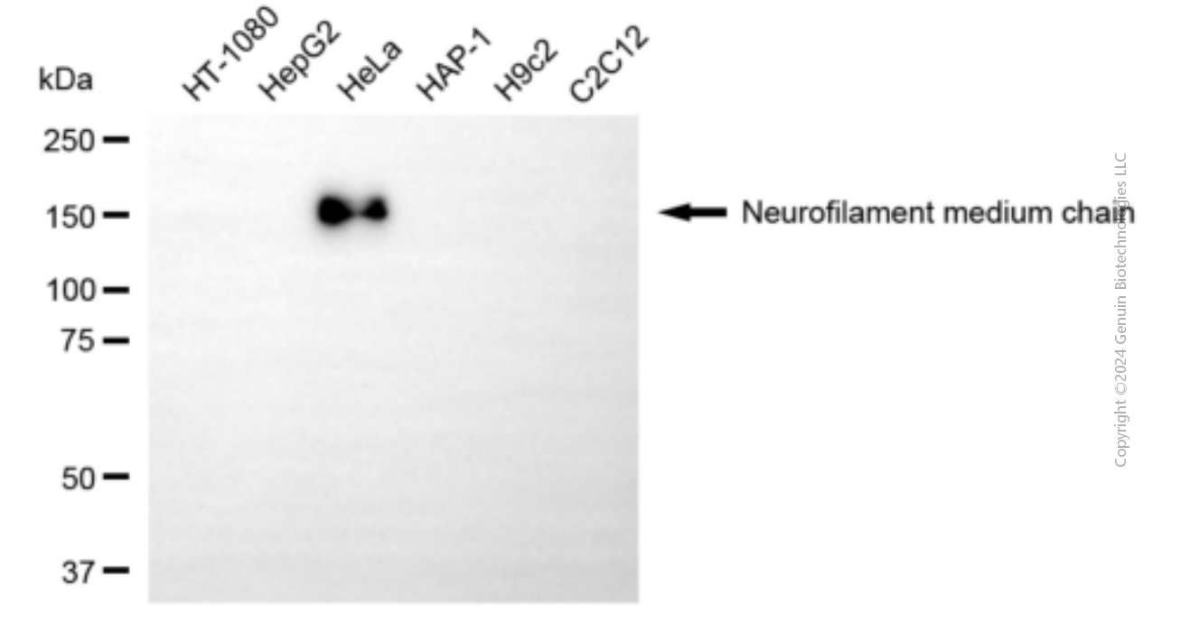 NEFM antibody