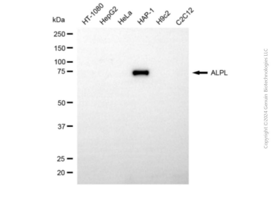 ALPL antibody