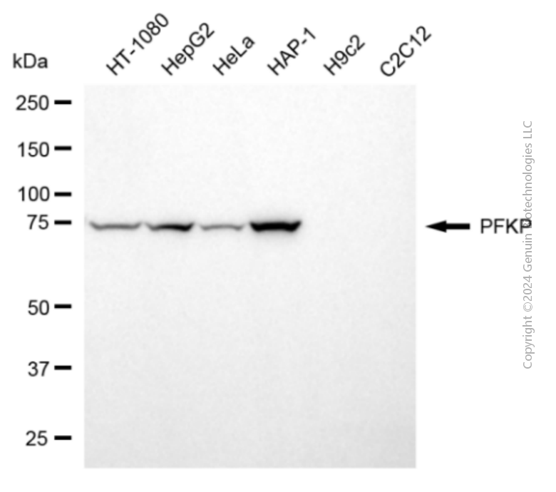 PFKP antibody
