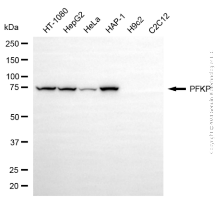 PFKP antibody