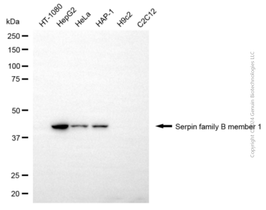 SERPINB1 antibody