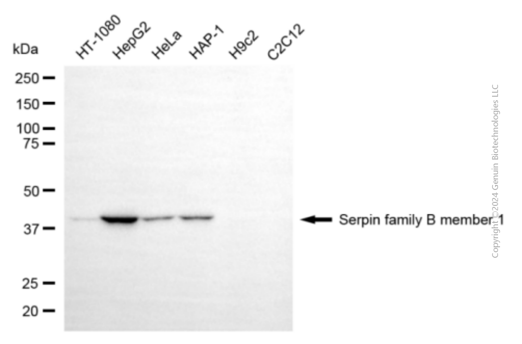 SERPINB1 antibody