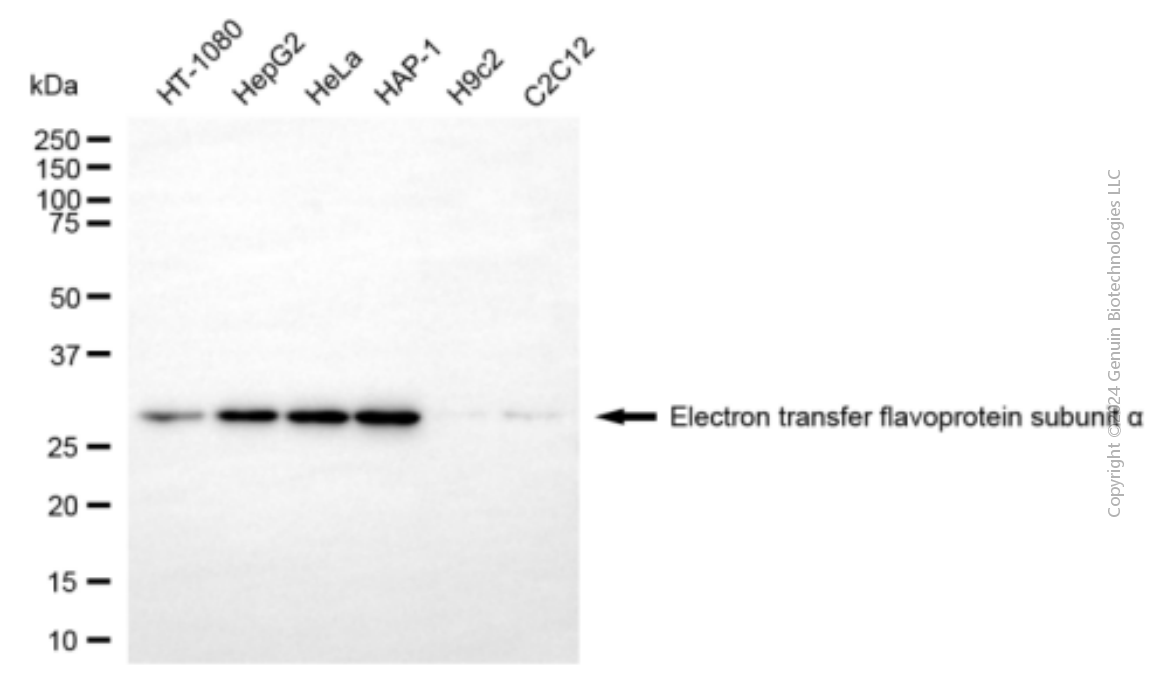 ETFA antibody
