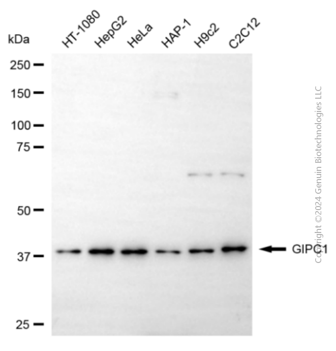GIPC1 antibody