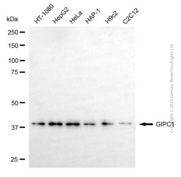GIPC1 antibody